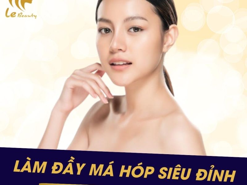 Làm đầy má hóp bằng Hyaluronic acid (chất tự thân)