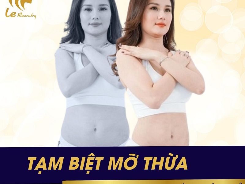 Giải pháp đột phá giảm cân không xâm lấn tại Le Beauty