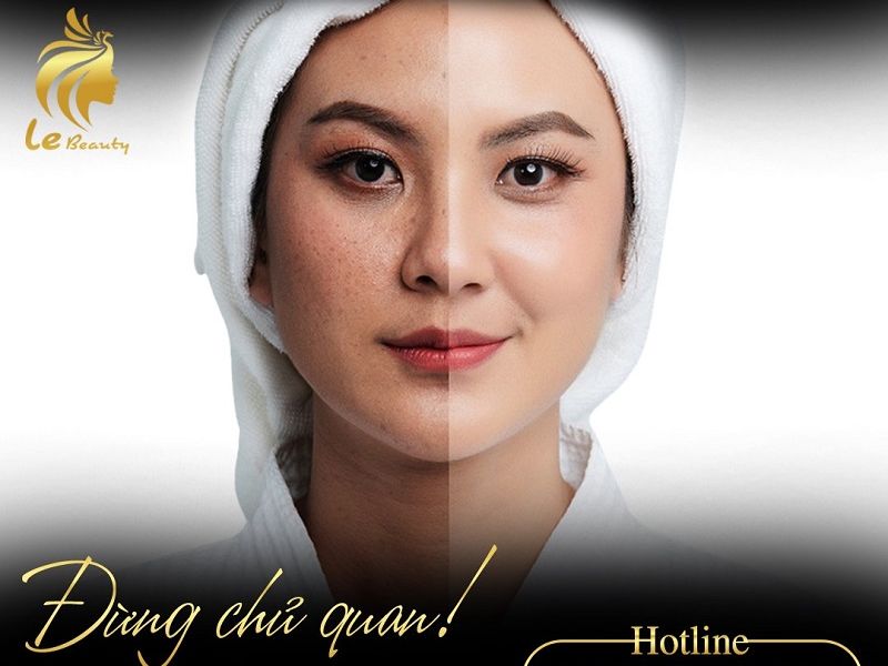 Tất tần tật các dịch vụ chăm sóc sắc đẹp gây bão tại Le Beauty