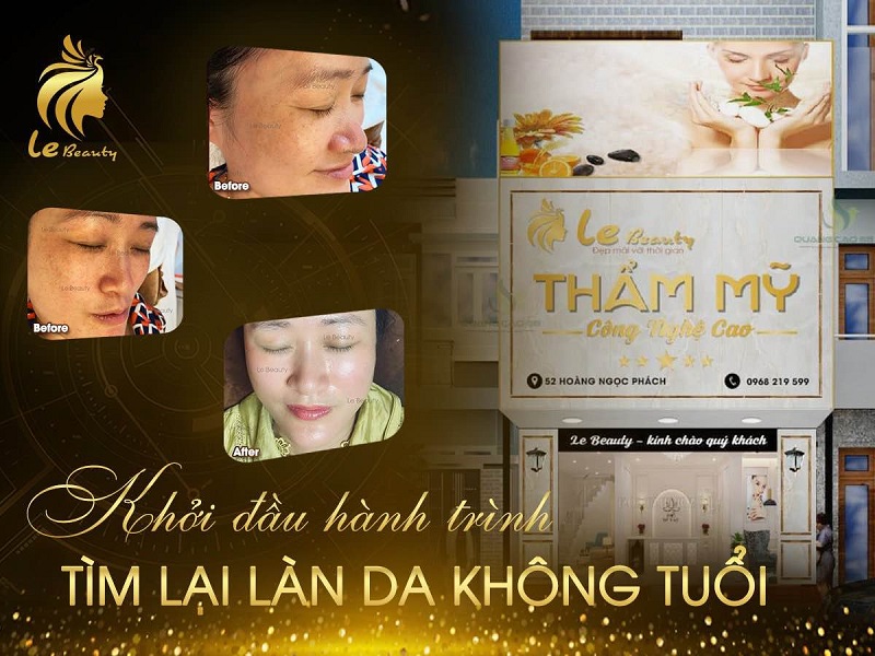 Le Beauty - Thẩm mỹ công nghệ cao, Nâng tầm nhan sắc Việt